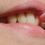 Comment entretenir ses couronnes dentaires