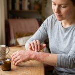 Allergies de Contact
